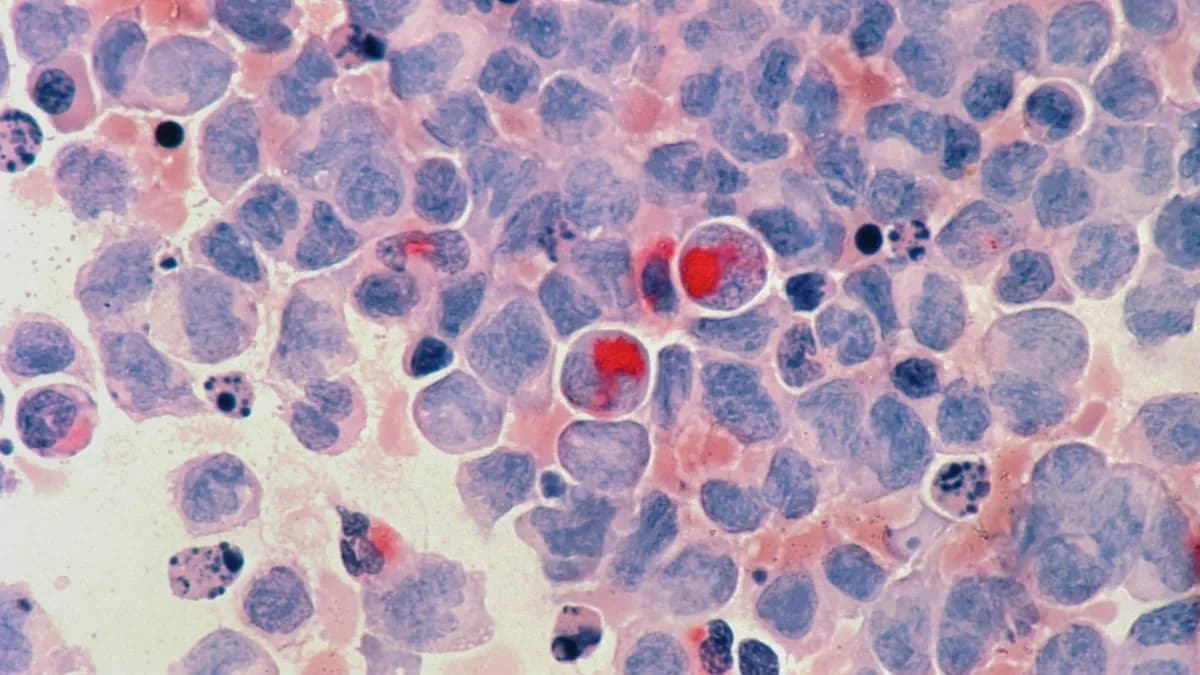 Nemzeti Rákellenes Nap: Hagyomány és Tudatosság a Középpontban